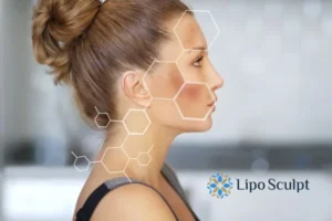Are you looking at age spots Warfield removal? Contact Lipo Sculpt today!