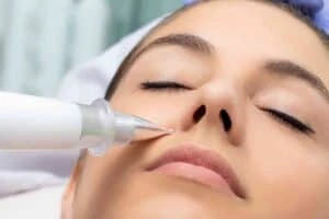 Best Actinic Keratoses Removal 3 Actinic keratoses Warfield solutions - book in today!