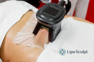 Fat freezing at home from Lipo Sculpt Warfield